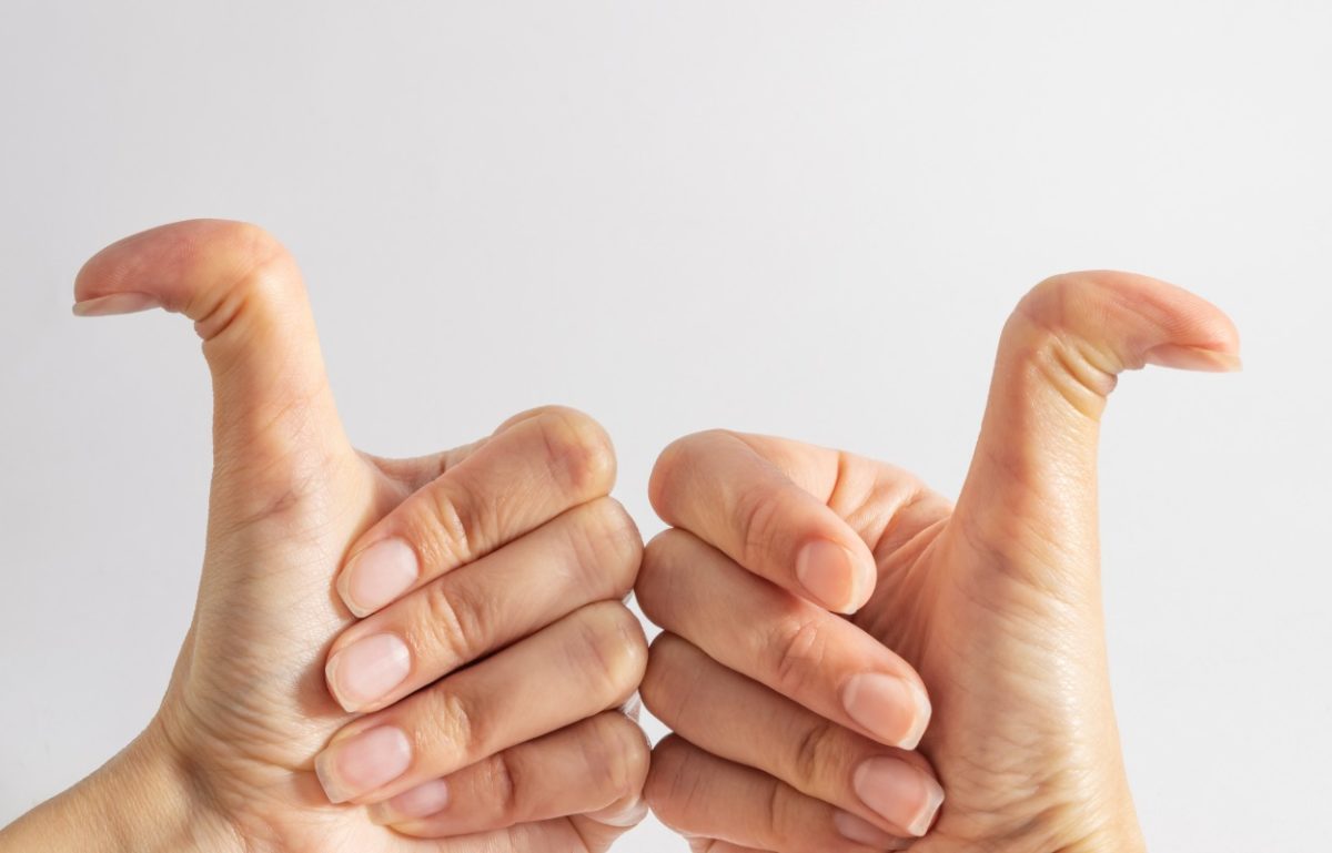 What Is EhlersDanlos Syndrome? Greenberg Regenerative Medicine